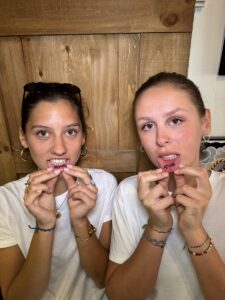 Dos clientas mostrando su inner lip tattoo XOXO recién hecho en Trip n' Tattoo Barcelona