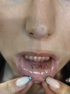 Inner lip tattoo desvanecido con el tiempo en el interior del labio inferior